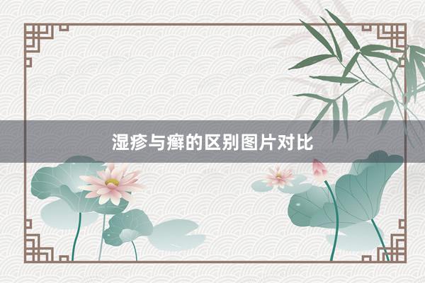 湿疹与癣的区别图片对比
